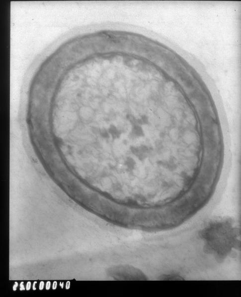 La cellule vivante et la résonance