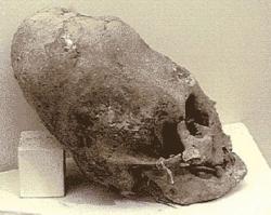 alien-ufo-extraterrestrial-face-head-skull-bone-anomalies-elongated-cranium-2-alien-skull.jpg