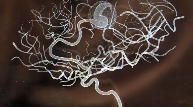 Physique quantique, coma et expériences de mort imminente