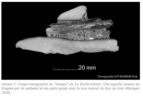 Neanderthal roche cotard10