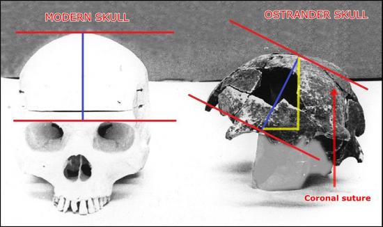 ostrander-skull.jpg