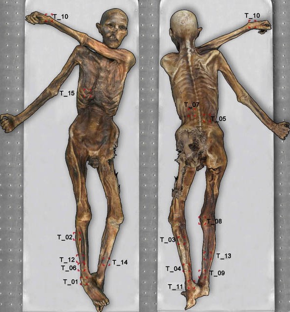 Otzi2