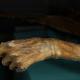 Les tatouages de la momie de Otzi révèlent la médecine de l'âge du cuivre