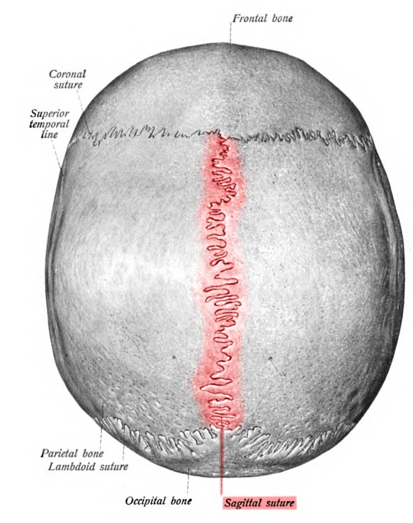 Sagittal suture