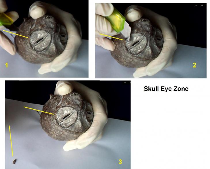 Skull eye zone