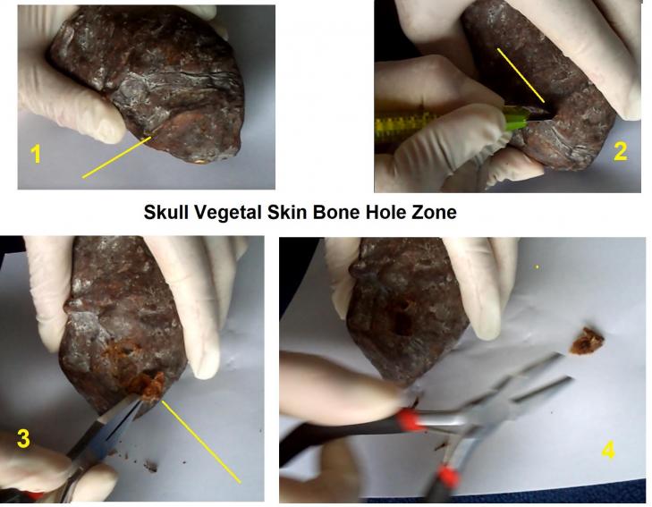 Skull vegetal skin bone hole zone