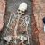 Un squelette au crane allongé découvert en Russie