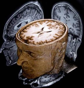 Pour quand le casque télépathique de l'armée américaine ?